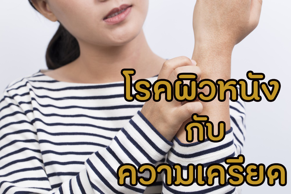 โรคผิวหนัง กับ ความเครียด thaihealth