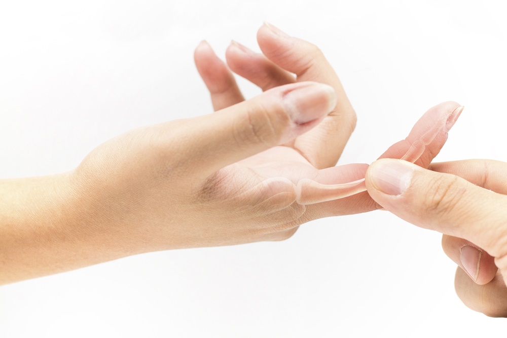 วัณโรคกระดูกที่นิ้วมือระยะแรกรักษาได้ thaihealth