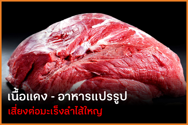 เนื้อแดง อาหารแปรรูป เสี่ยงต่อมะเร็งลำไส้ใหญ่ thaihealth