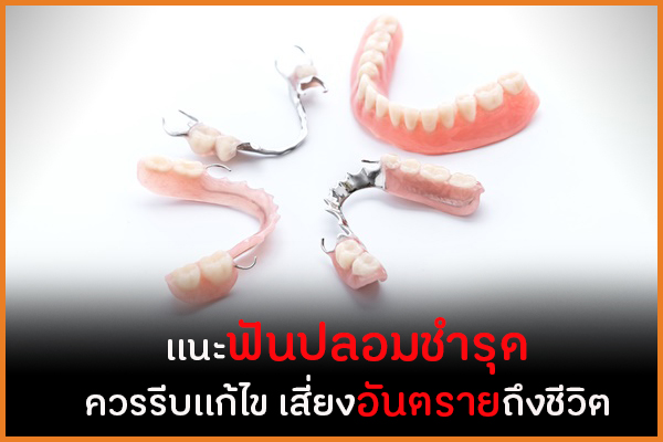เเนะฟันปลอมชำรุด ควรรีบเเก้ไข เสี่ยงอันตรายถึงชีวิต thaihealth