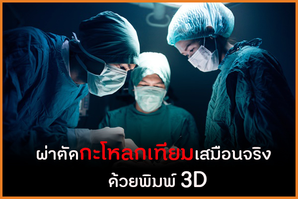 ผ่าตัดกะโหลกเทียมเสมือนจริง ด้วยพิมพ์ 3D thaihealth