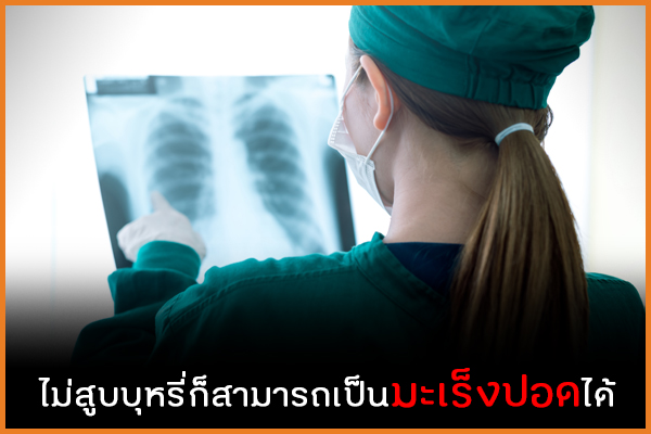 ไม่สูบบุหรี่ก็สามารถเป็นมะเร็งปอดได้ thaihealth