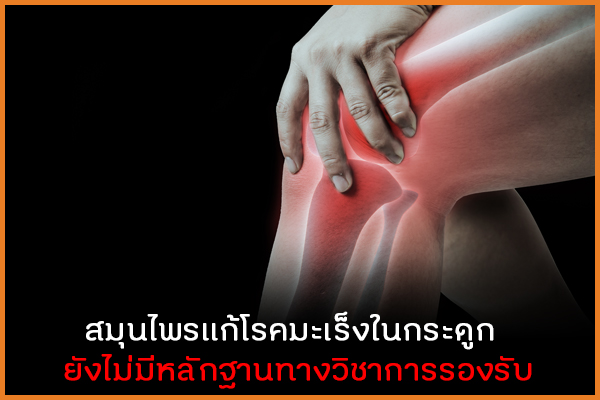 สมุนไพรแก้โรคมะเร็งในกระดูก  ยังไม่มีหลักฐานทางวิชาการรองรับ thaihealth