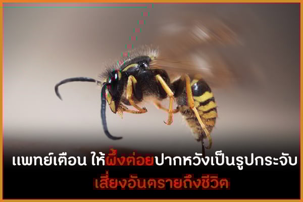 เเพทย์เตือน ให้ผึ้งต่อยปากหวังเป็นรูปกระจับ เสี่ยงอันตรายถึงชีวิต thaihealth
