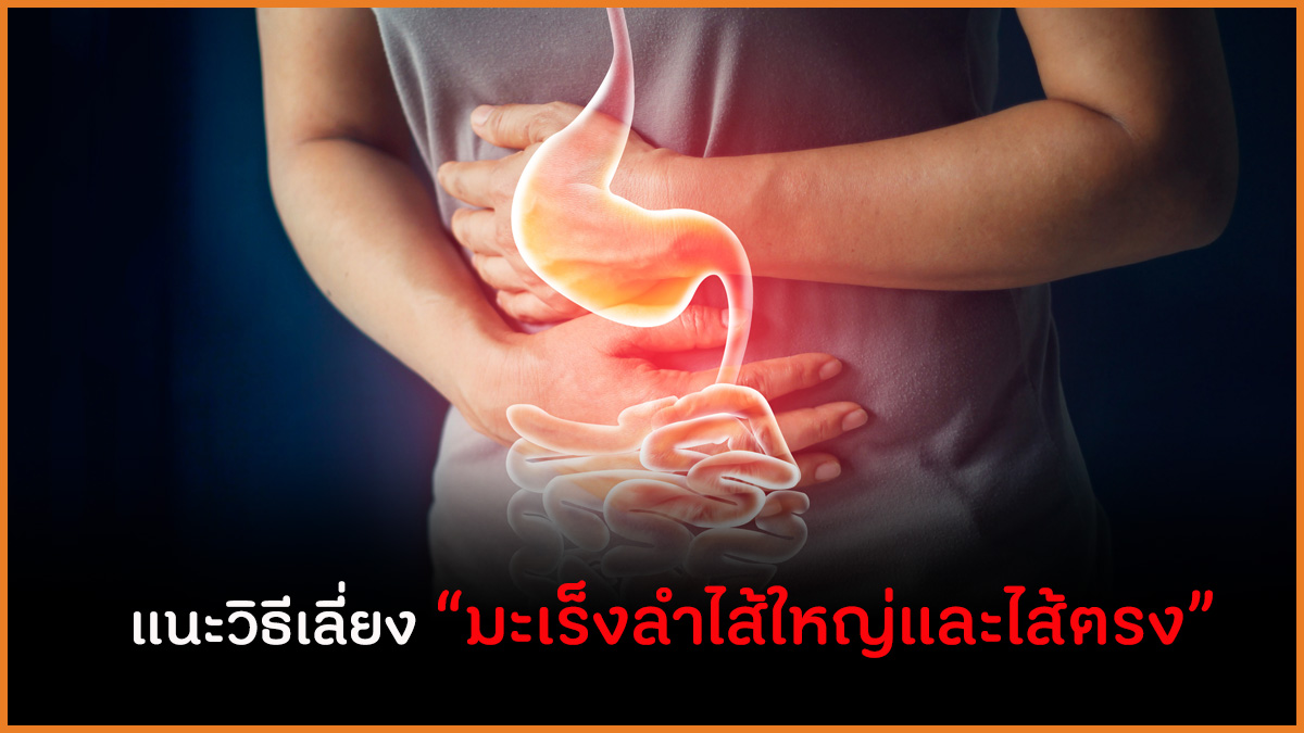 แนะวิธีเลี่ยง “มะเร็งลำไส้ใหญ่และไส้ตรง” thaihealth