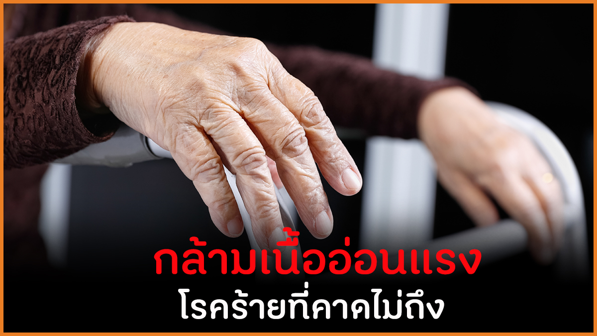 กล้ามเนื้ออ่อนแรง โรคร้ายที่คาดไม่ถึง thaihealth