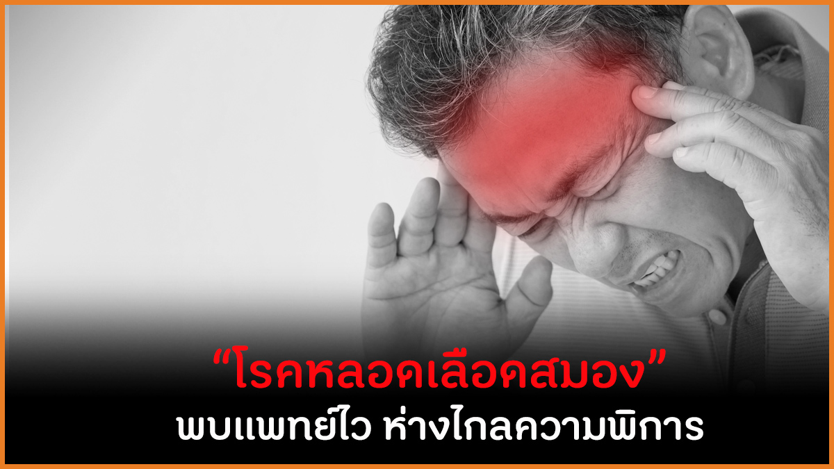 “โรคหลอดเลือดสมอง” พบแพทย์ไว ห่างไกลความพิการ thaihealth