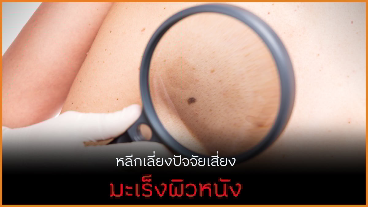 หลีกเลี่ยงปัจจัยเสี่ยง ลดมะเร็งผิวหนัง thaihealth