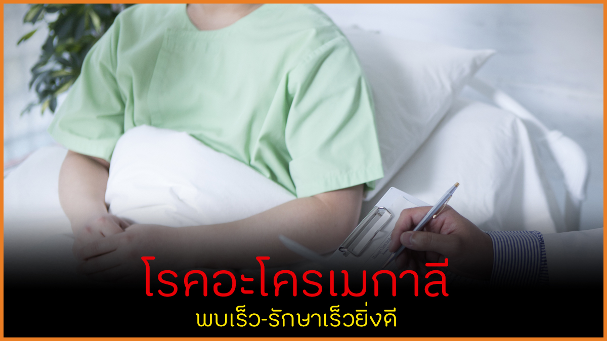 โรคอะโครเมกาลี พบเร็ว-รักษาเร็วยิ่งดี thaihealth