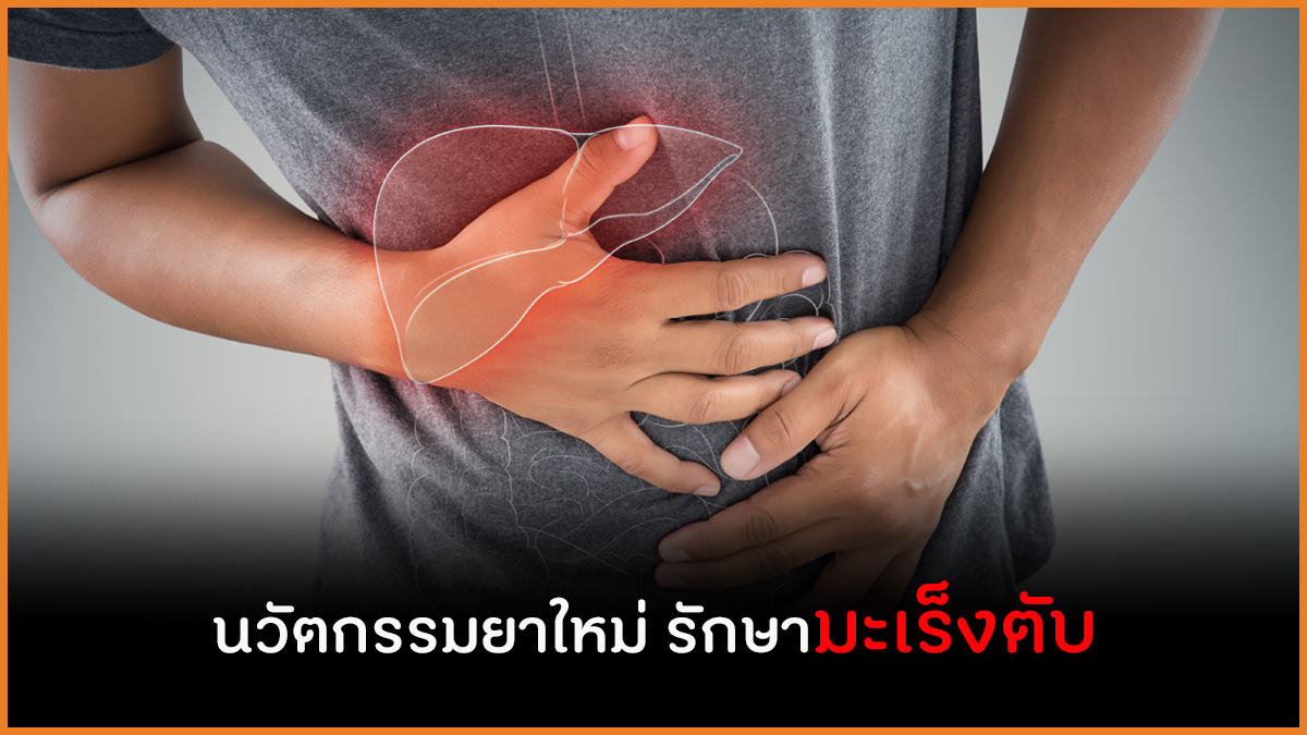 นวัตกรรมยาใหม่ รักษามะเร็งตับ thaihealth