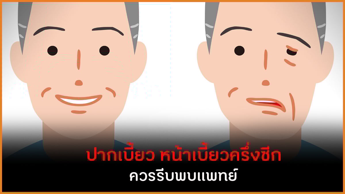 ปากเบี้ยว หน้าเบี้ยวครึ่งซีก ควรรีบพบแพทย์ thaihealth