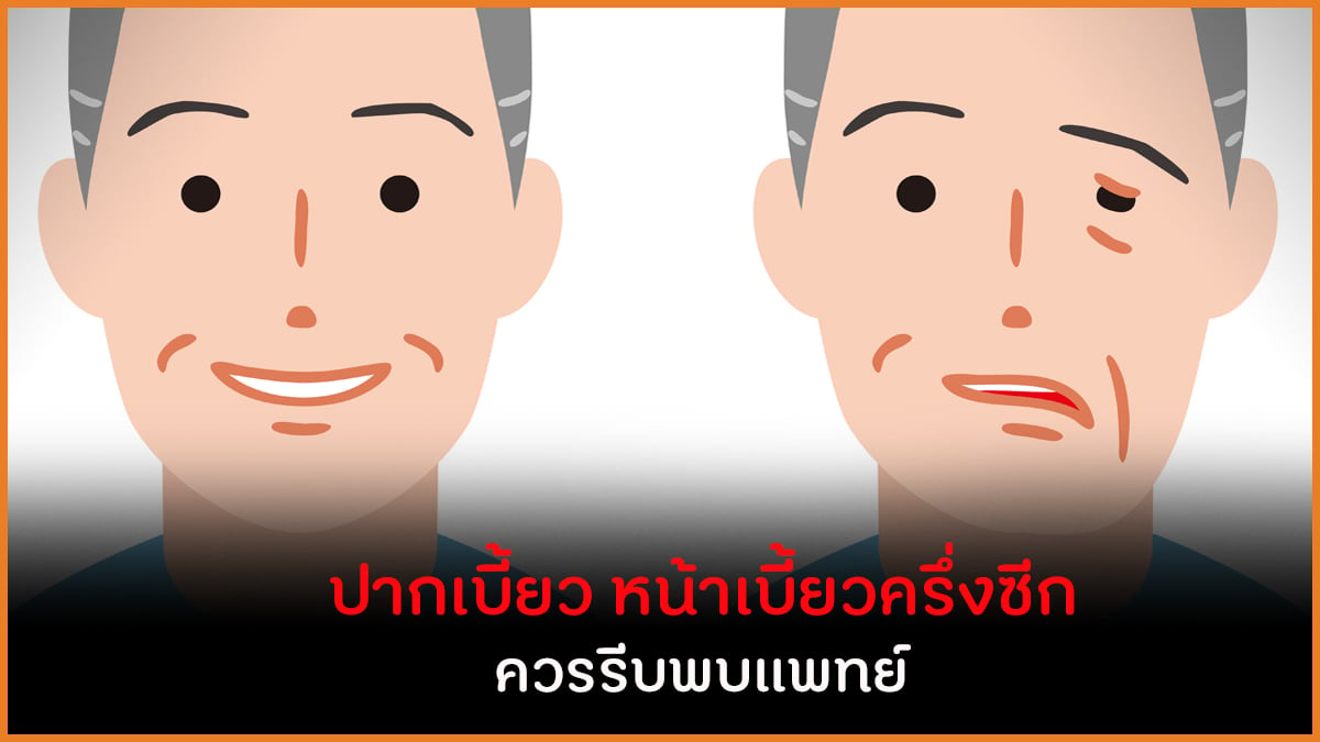 ปากเบี้ยว หน้าเบี้ยวครึ่งซีก ควรรีบพบแพทย์ thaihealth