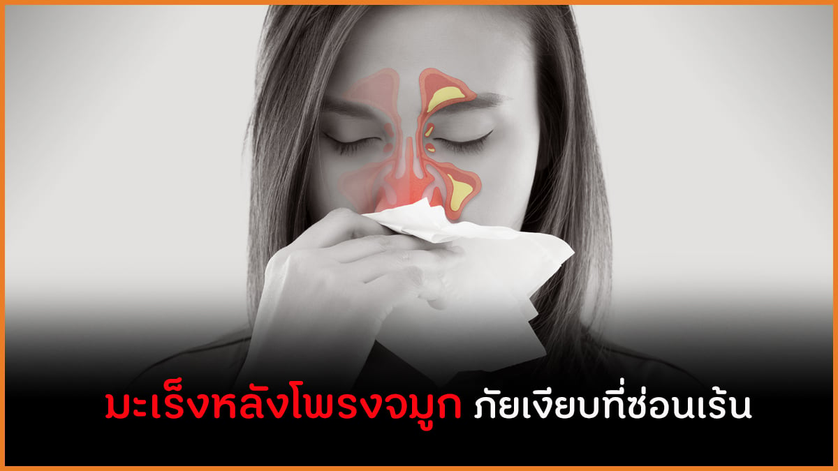 มะเร็งหลังโพรงจมูก ภัยเงียบที่ซ่อนเร้น  thaihealth