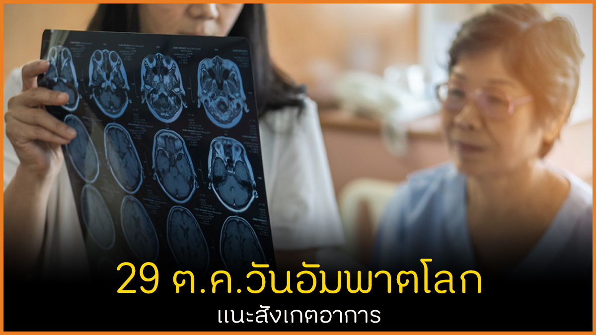 29 ต.ค.วันอัมพาตโลก แนะสังเกตอาการ thaihealth