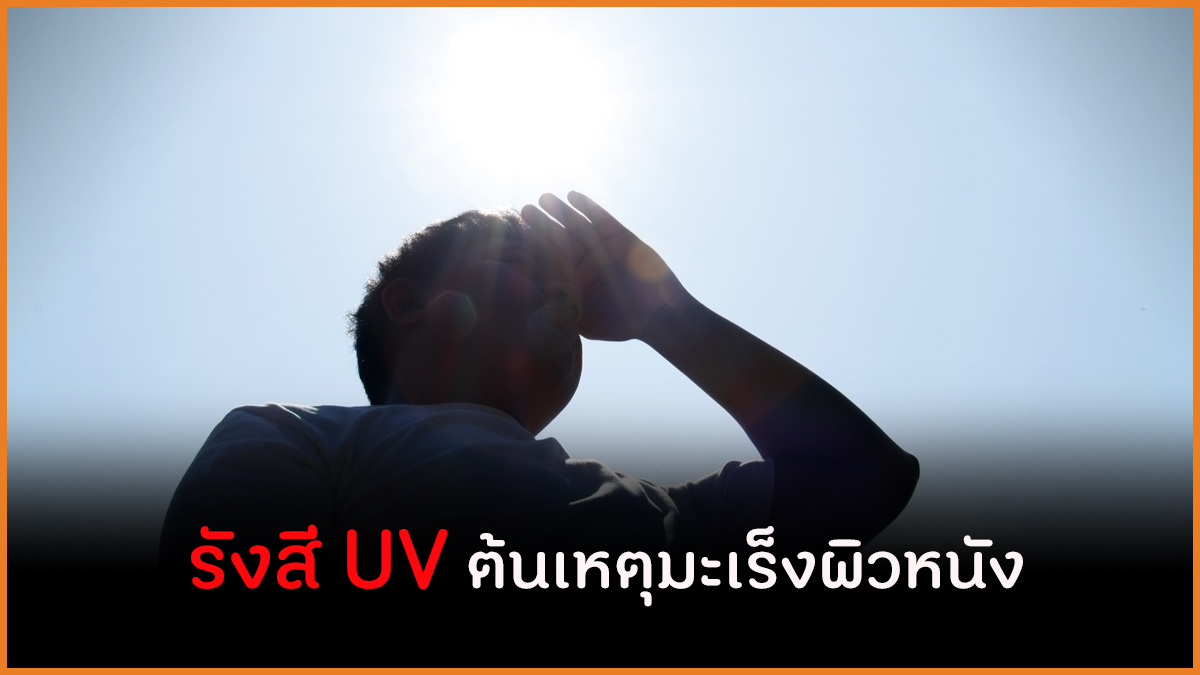 รังสี UV ต้นเหตุมะเร็งผิวหนัง thaihealth