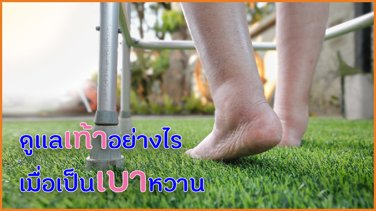 ดูแลเท้าอย่างไร เมื่อเป็นเบาหวาน thaihealth