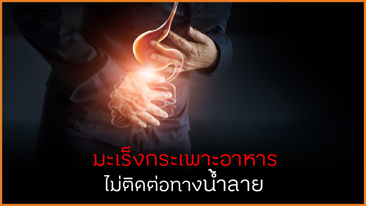 มะเร็งกระเพาะอาหาร ไม่ติดต่อทางน้ำลาย thaihealth
