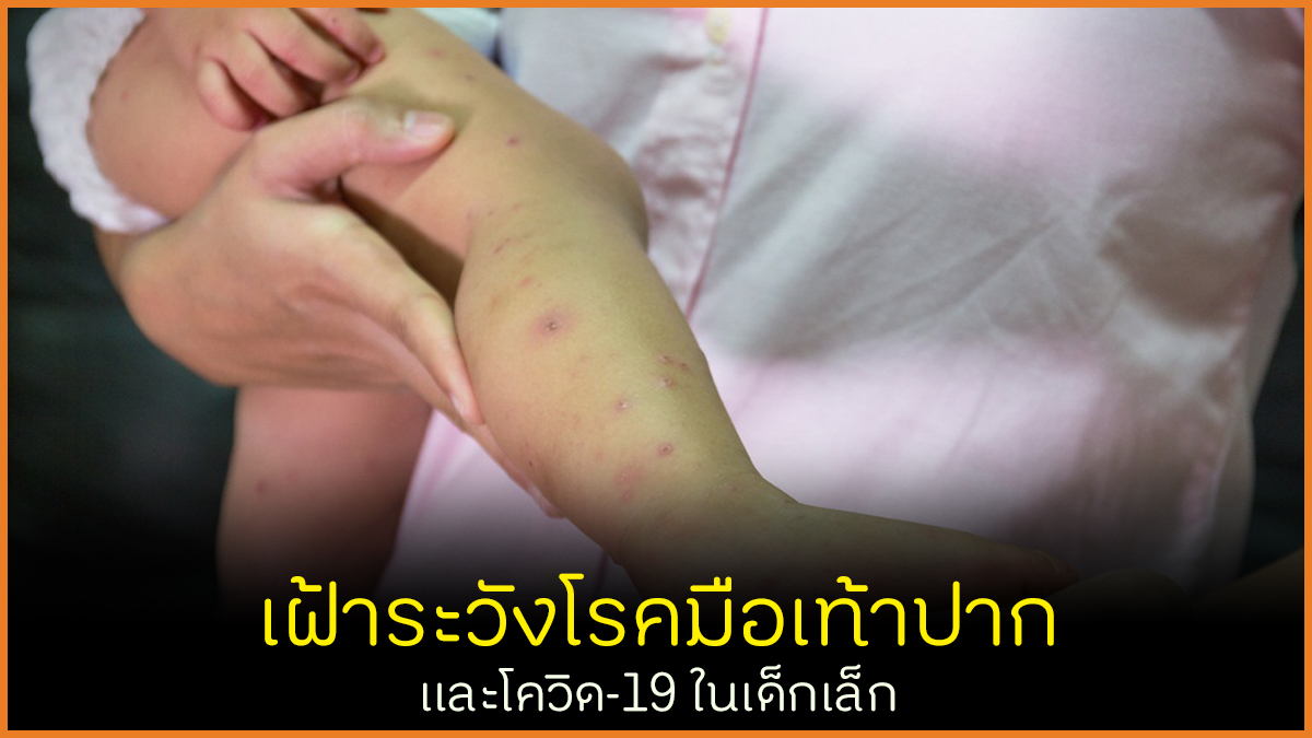 เฝ้าระวังโรคมือเท้าปากและโควิด-19 ในเด็กเล็ก thaihealth