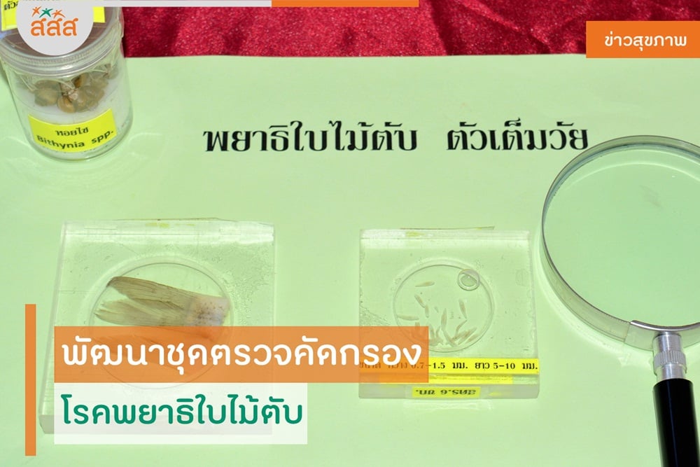 พัฒนาชุดตรวจคัดกรอง โรคพยาธิใบไม้ตับ thaihealth