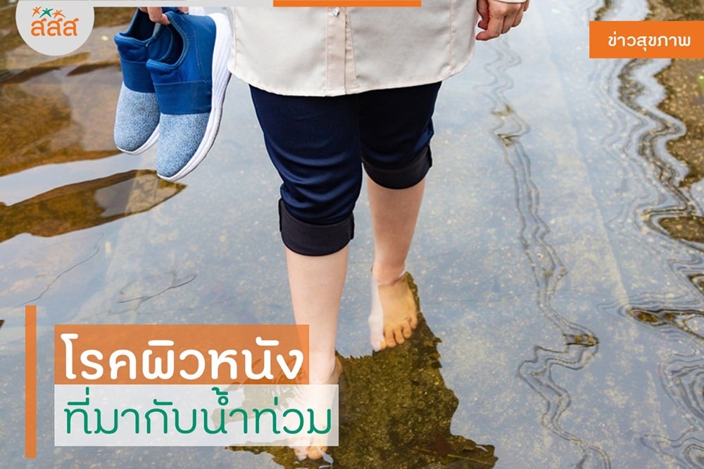 โรคผิวหนัง ที่มากับน้ำท่วม thaihealth