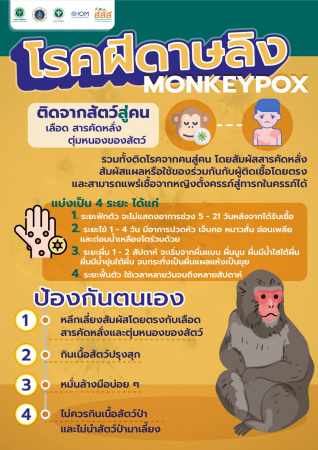 โรคฝีดาษลิง Monkey Pox โรคฝีดาษลิง Monkey Pox