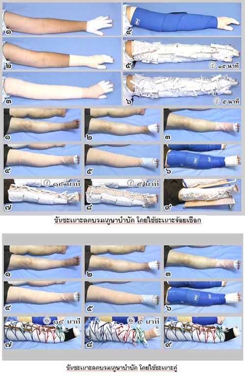 “โรคประหลาด” แต่หายได้โดยไม่ต้องพึ่งยา