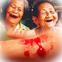 บาดทะยัก ภัยใกล้ตัวพบมากในคนแก่