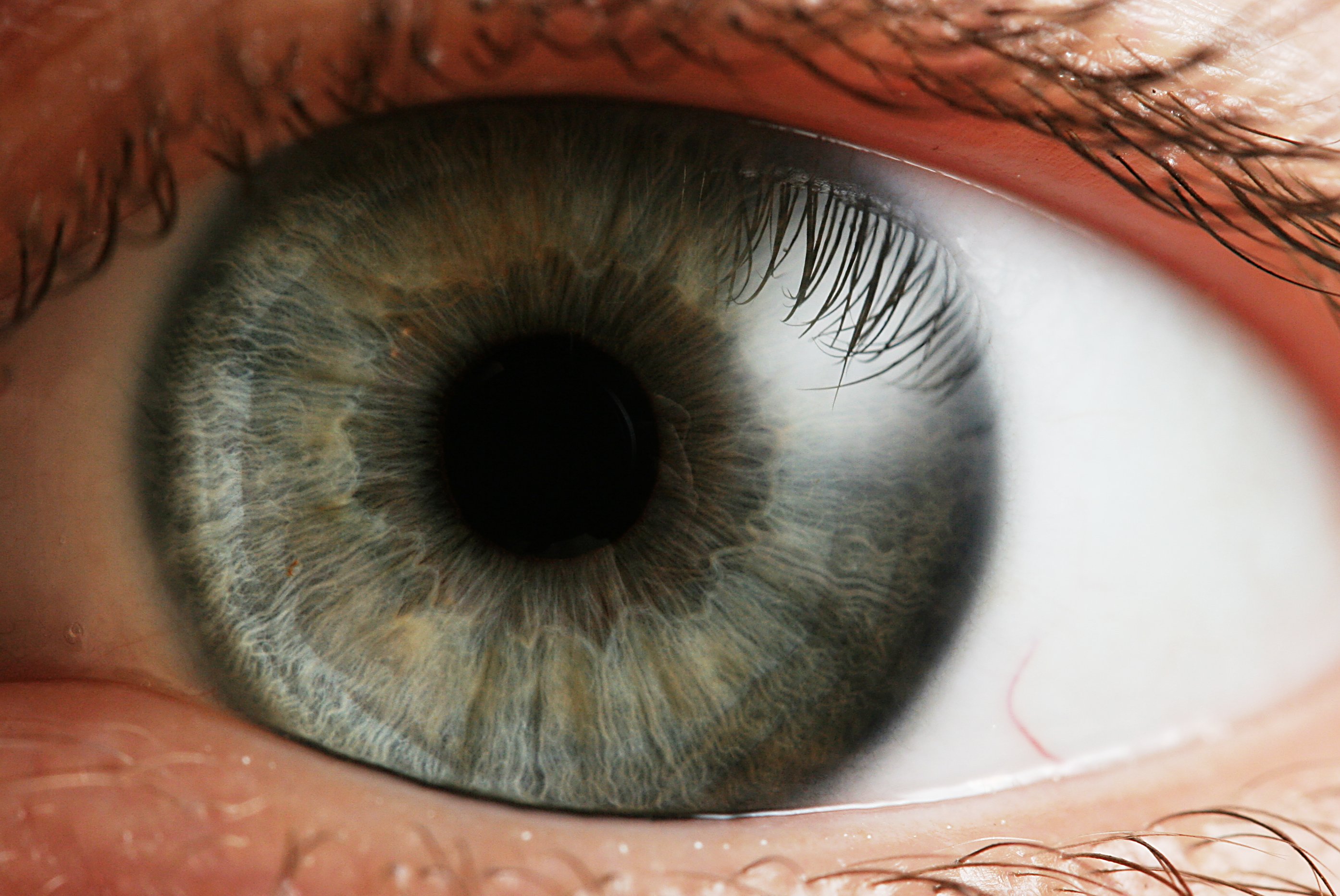ภาวะสายตาผิดปกติ thaihealth
