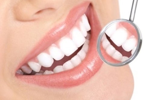 ทำฟันขาว 'วีเนียร์' เสี่ยงเหงือกร่นปากเหม็น -  สำนักงานกองทุนสนับสนุนการสร้างเสริมสุขภาพ (สสส.)