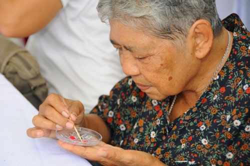 โรคลมชักอันตรายอาจทุพพลภาพ thaihealth