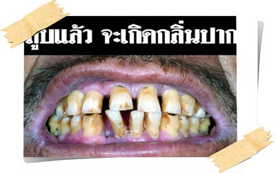 เริ่มแล้ววันนี้เพิ่มขนาดภาพเตือนภัยบุหรี่